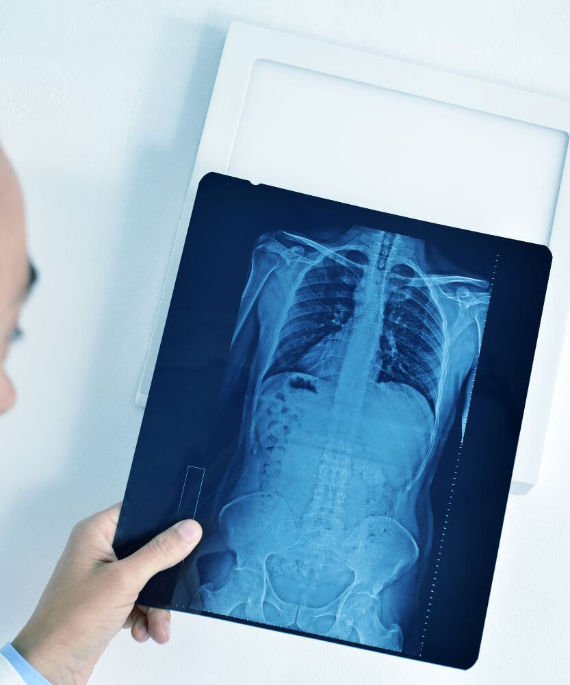 Doctor inspecting an X-ray image.